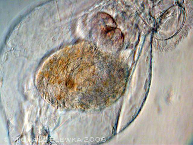 Leben im Teich Parasiten bei Rotaria macrura (Bdelloidea, Rotatoria